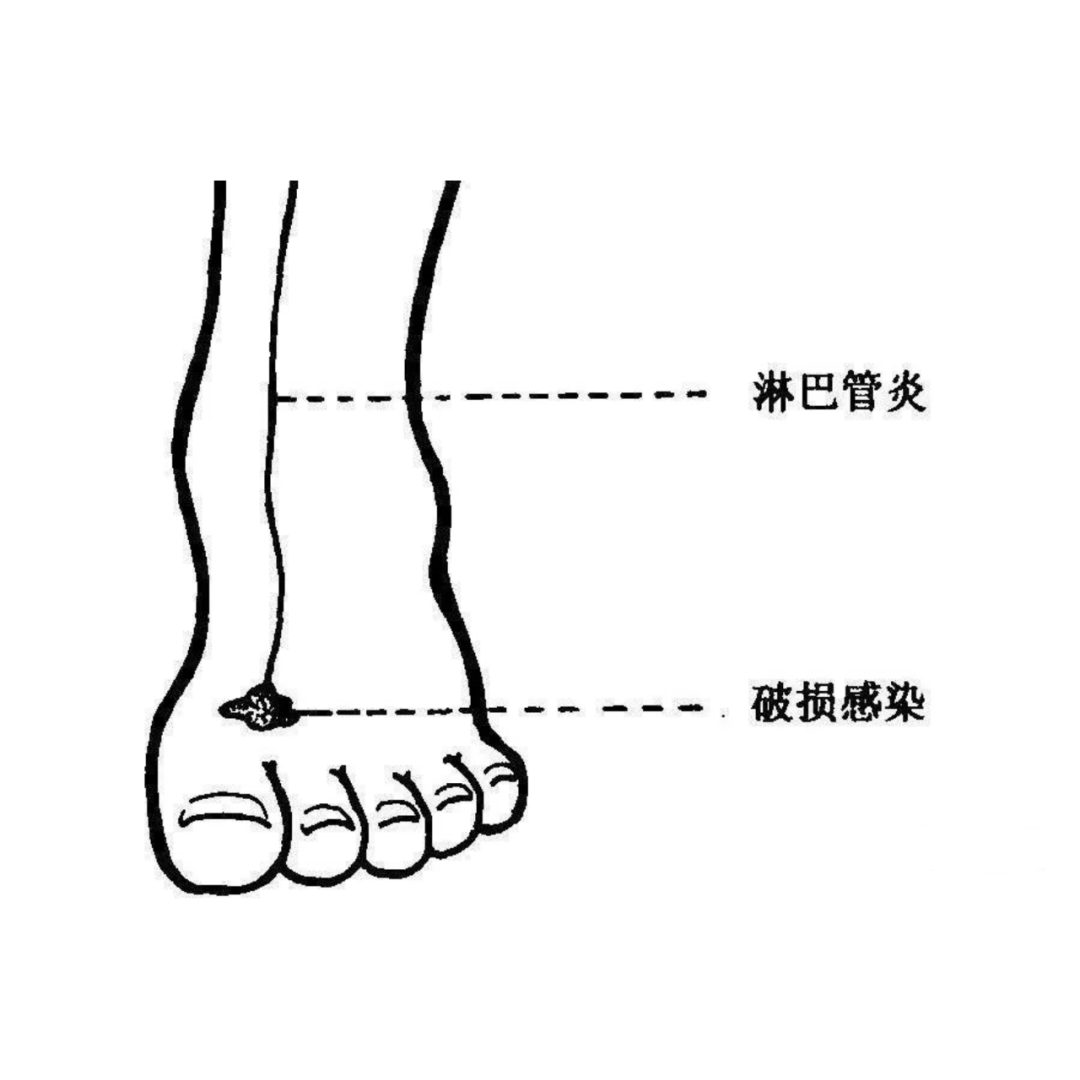 ͼƬ