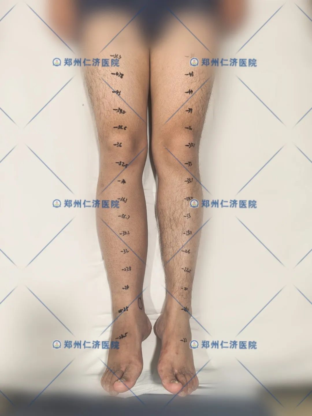 ͼƬ