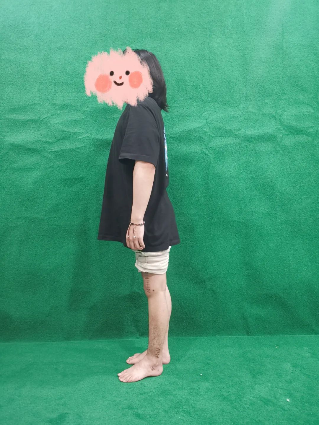 ͼƬ