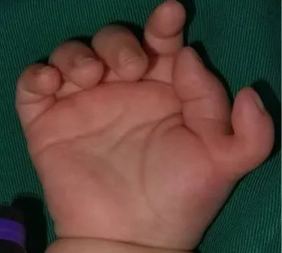 ͼƬ
