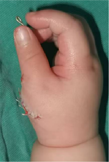 ͼƬ