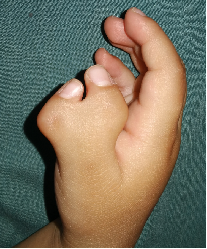 ͼƬ