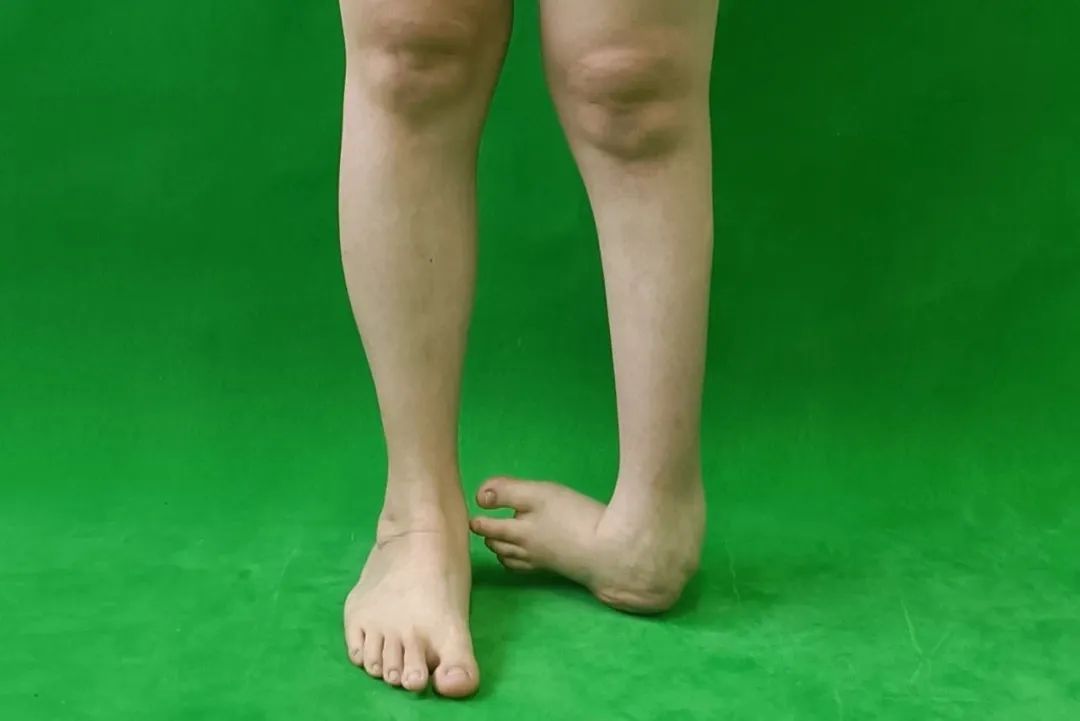 ͼƬ