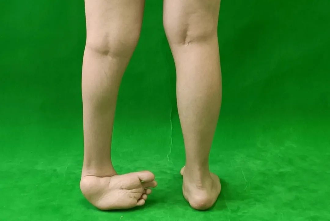 ͼƬ