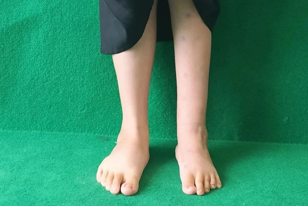 ͼƬ