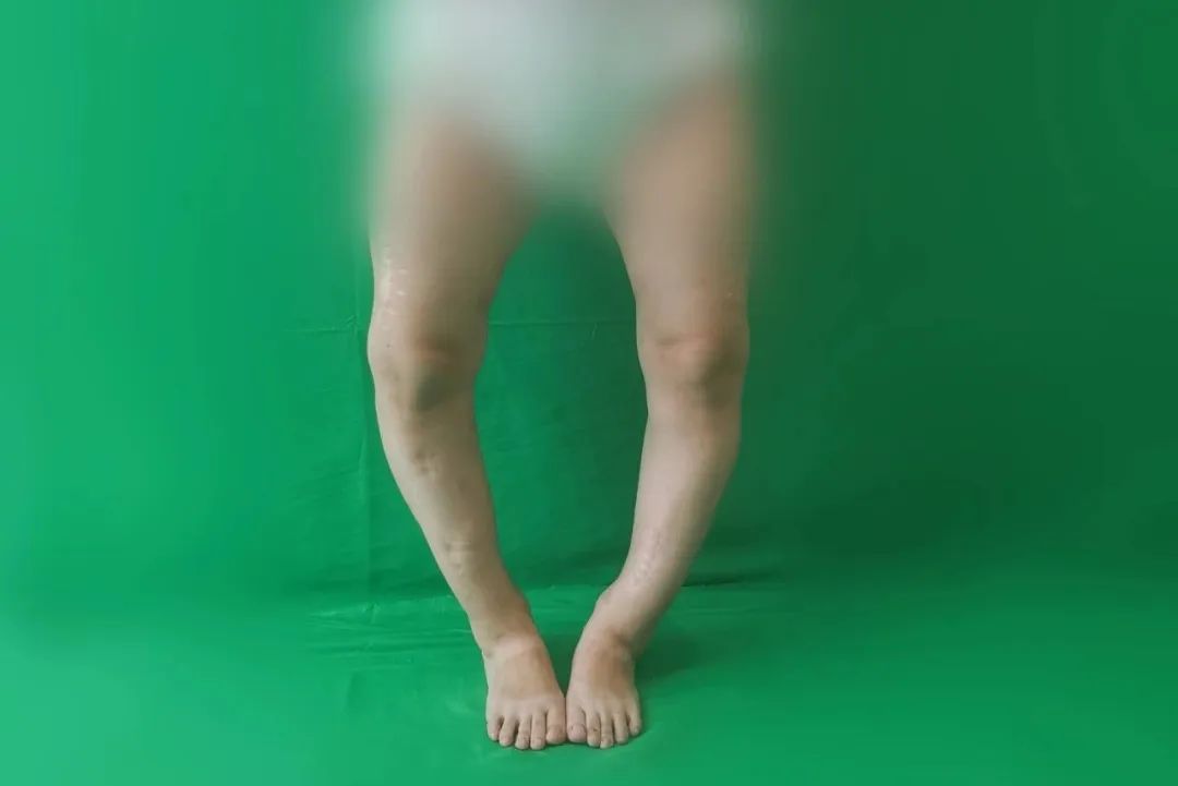 ͼƬ