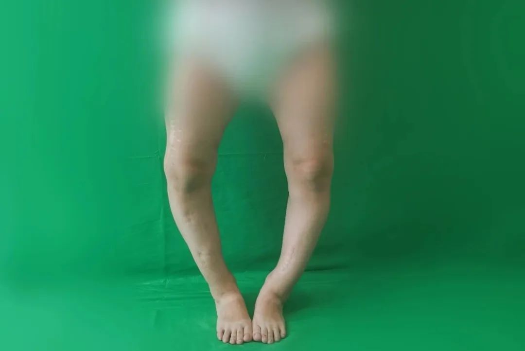 ͼƬ