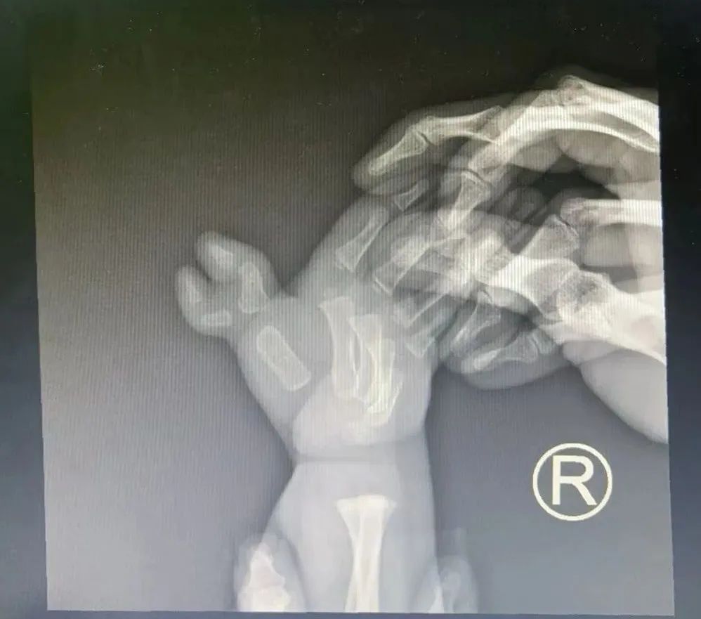 ͼƬ