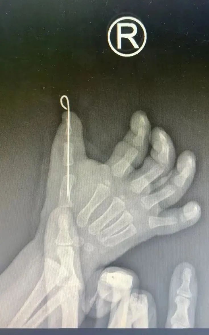 ͼƬ