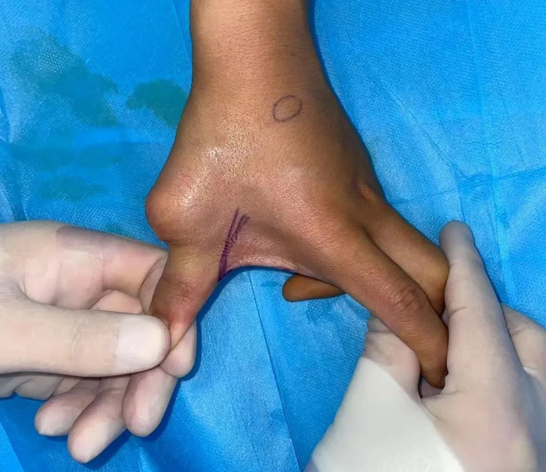 ͼƬ