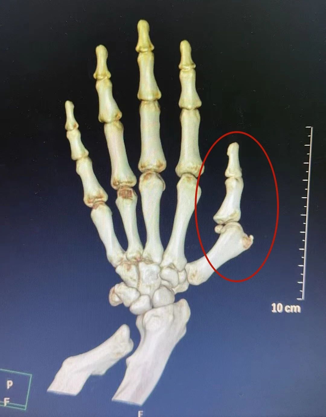 ͼƬ