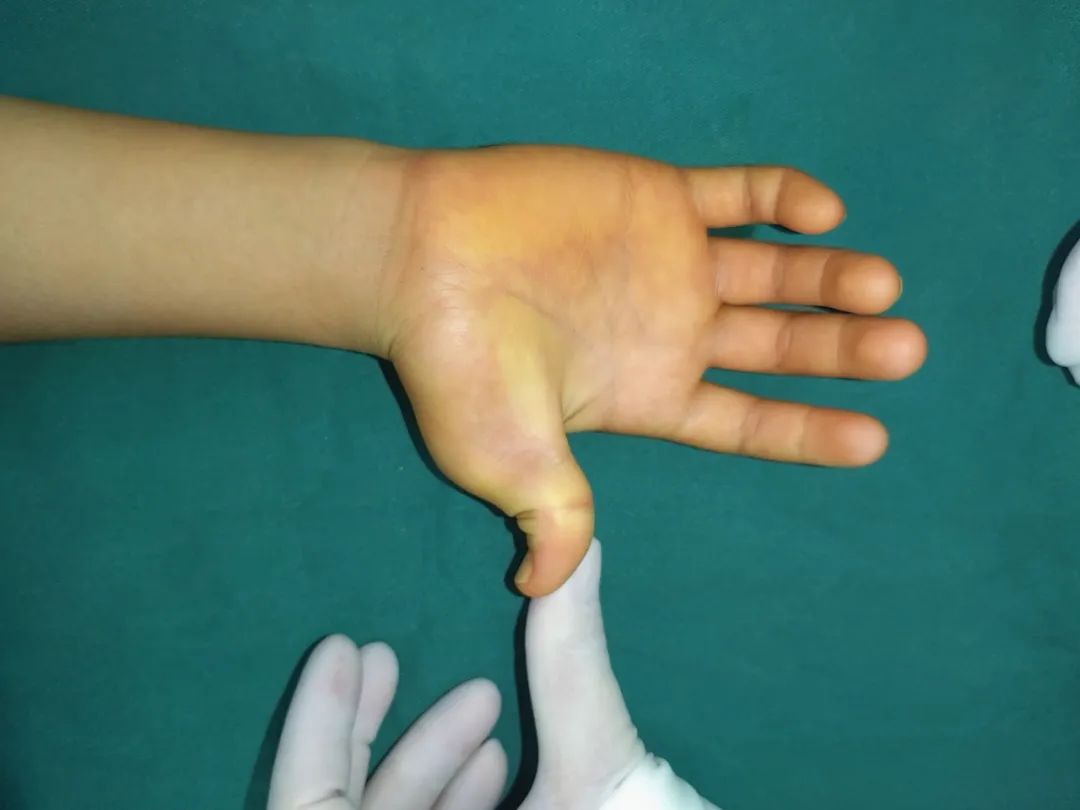 ͼƬ