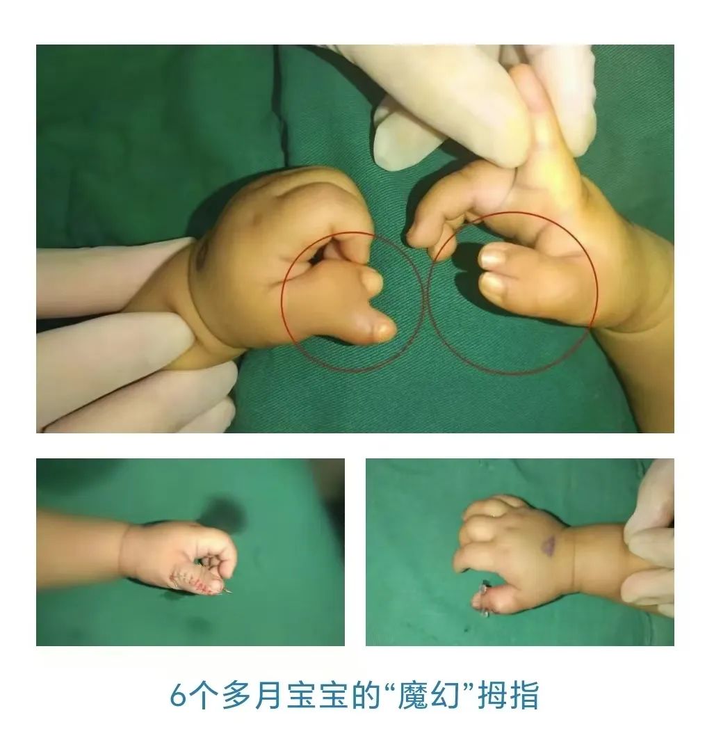 ͼƬ