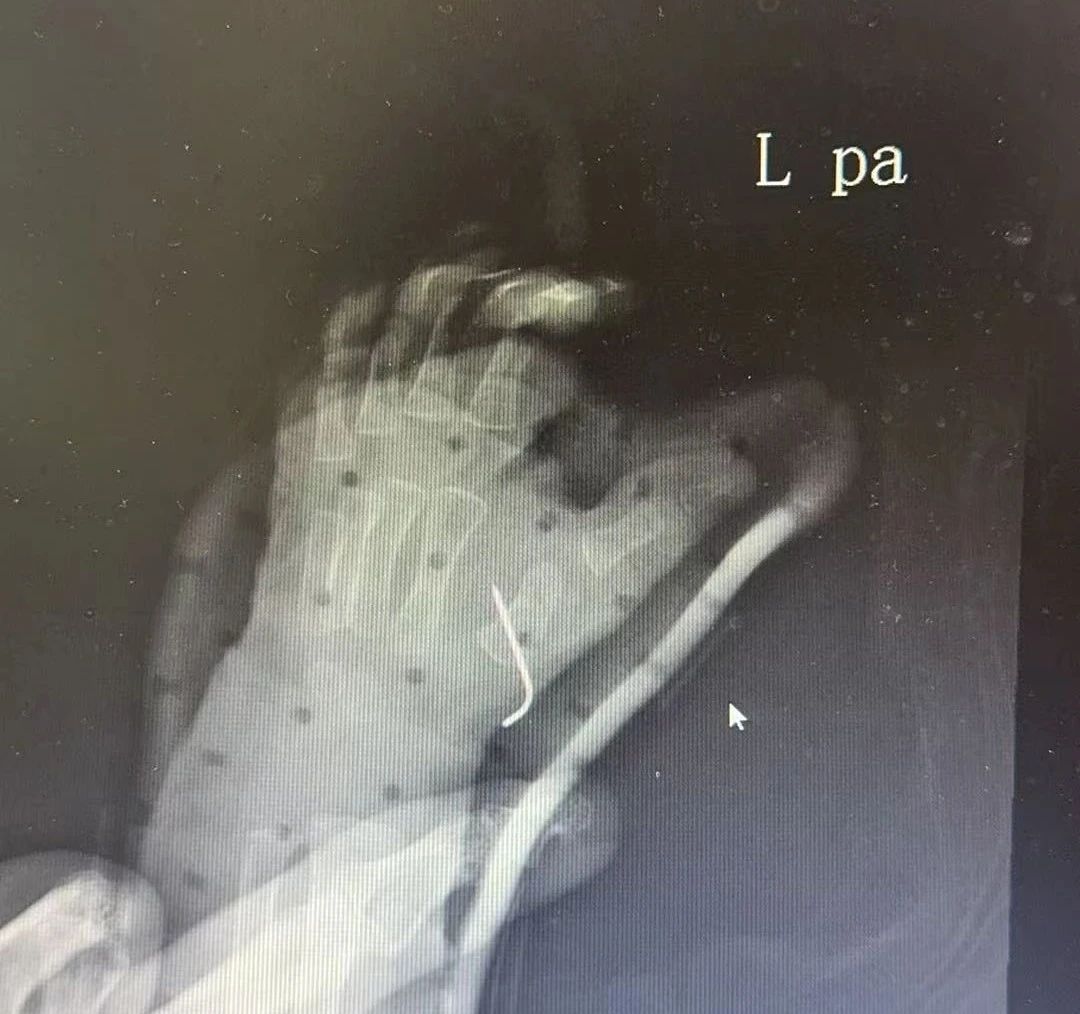 ͼƬ