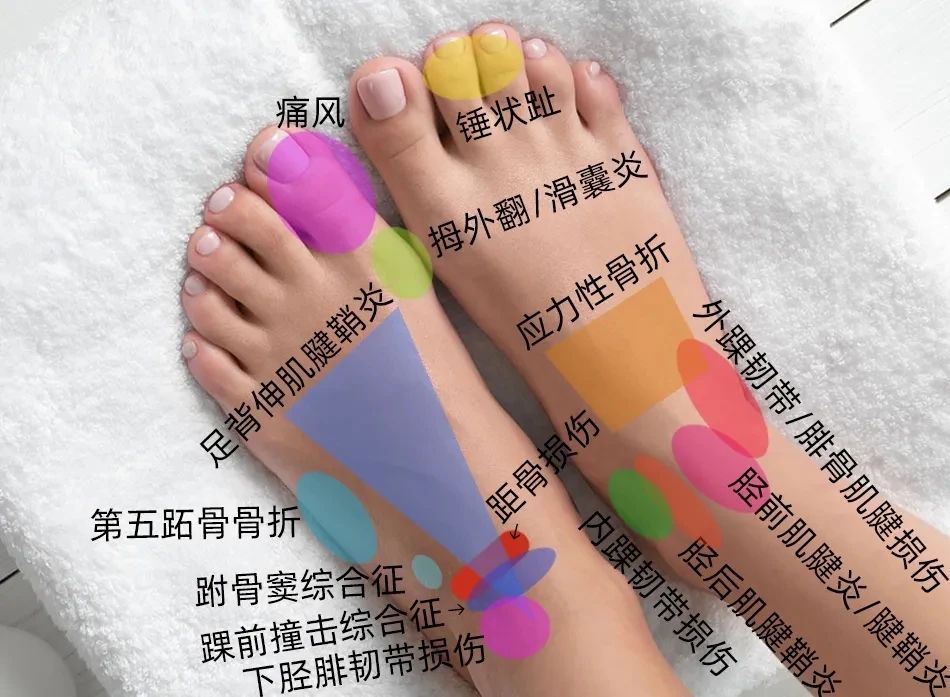 ͼƬ