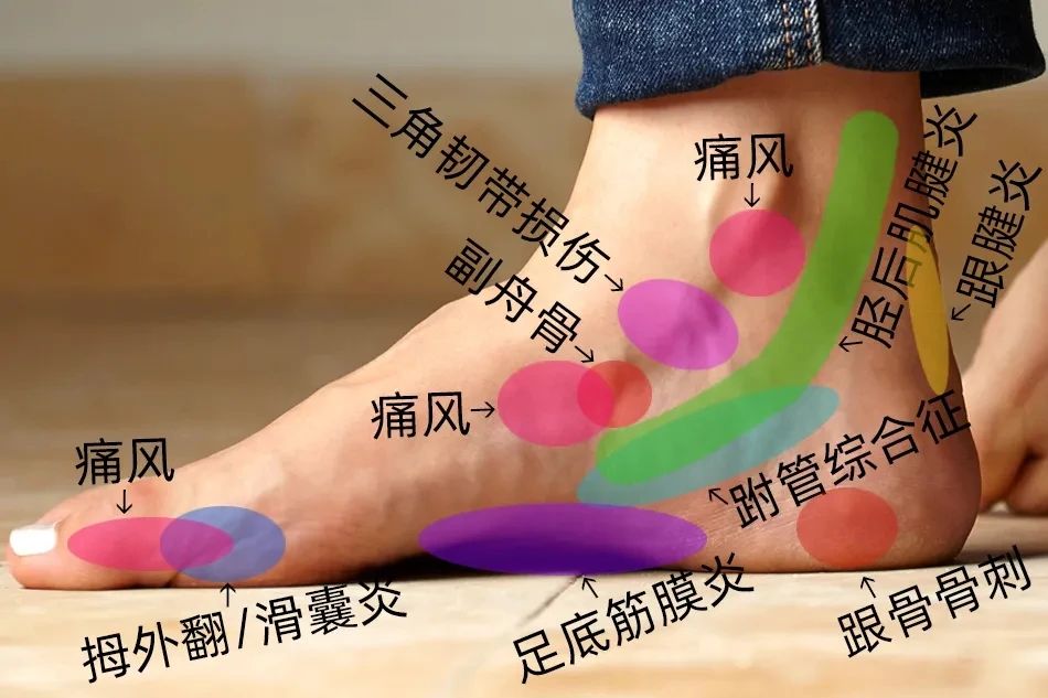 ͼƬ