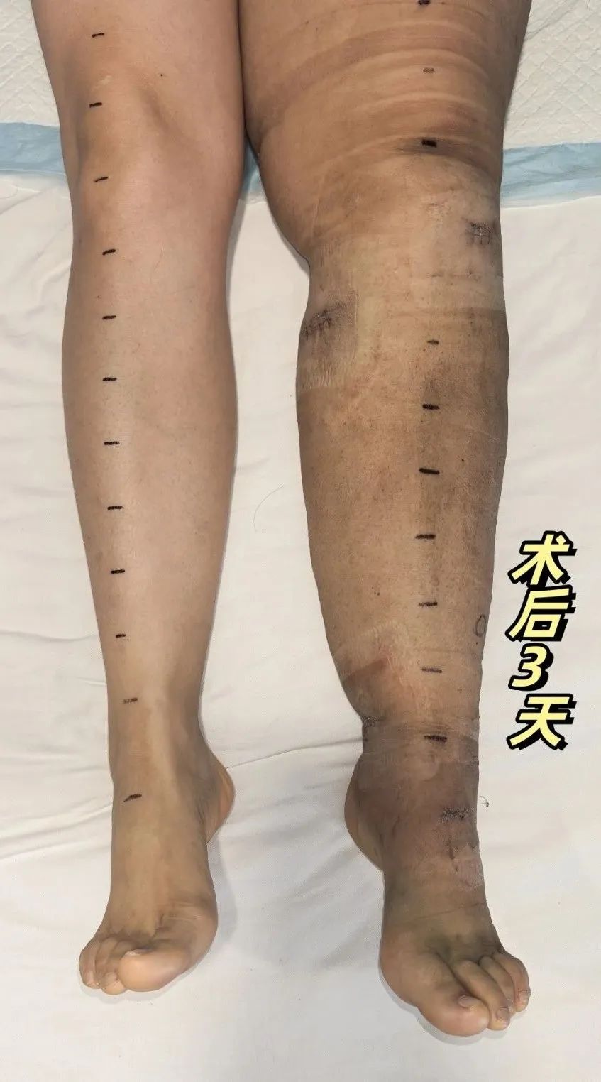 ͼƬ