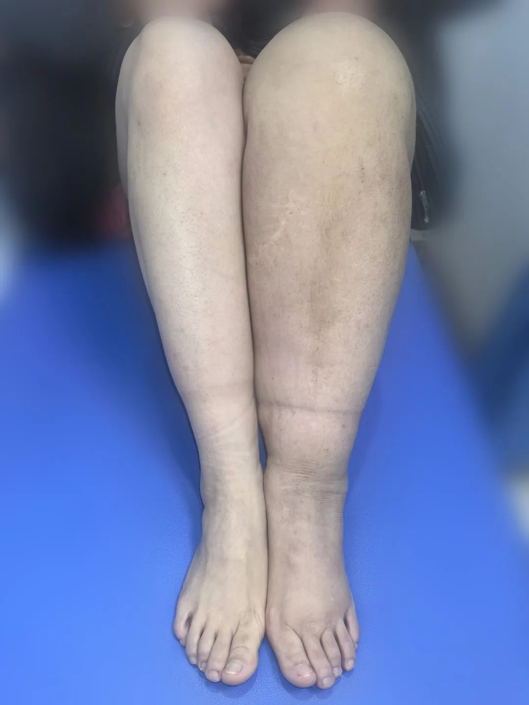 ͼƬ