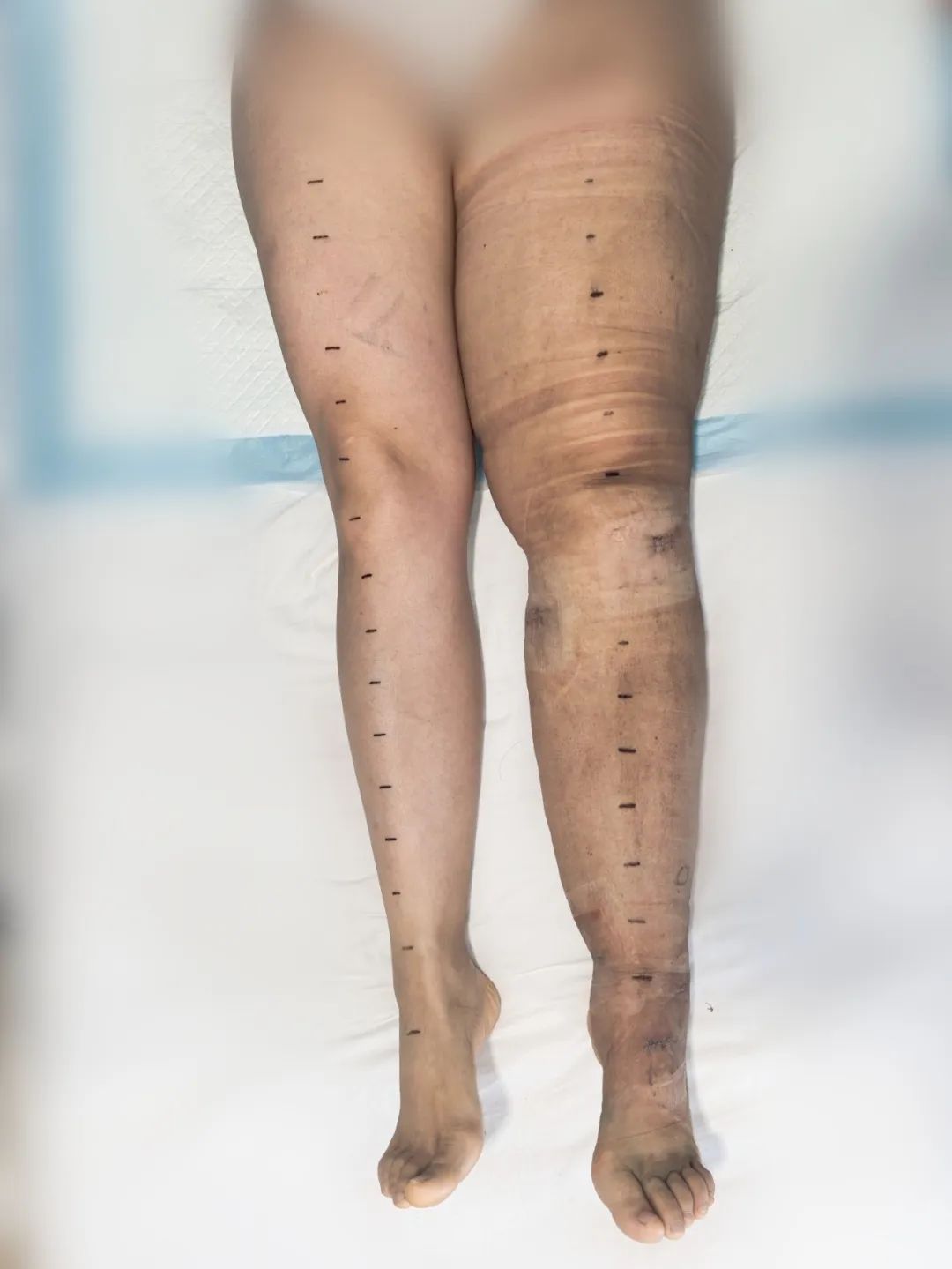 ͼƬ