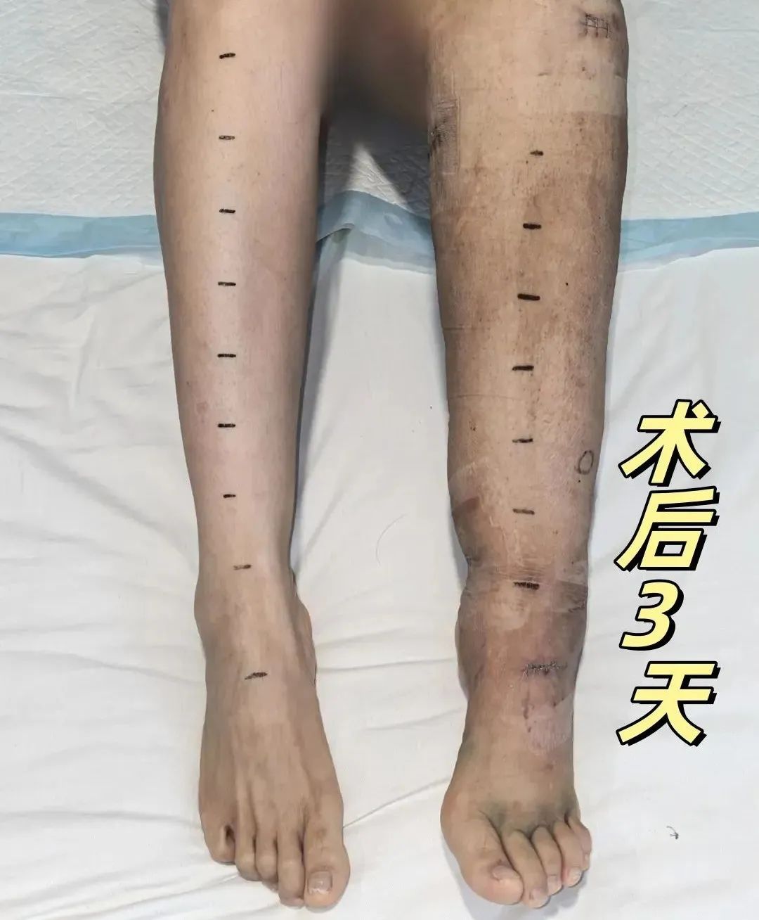 ͼƬ