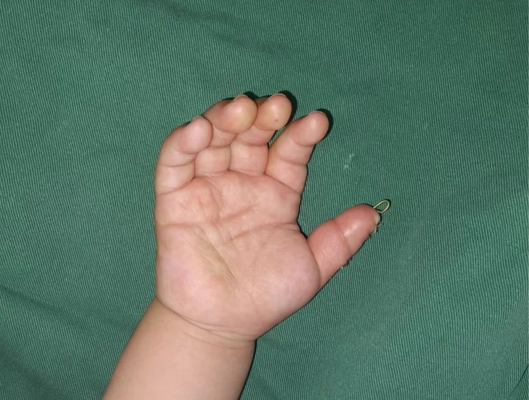 ͼƬ