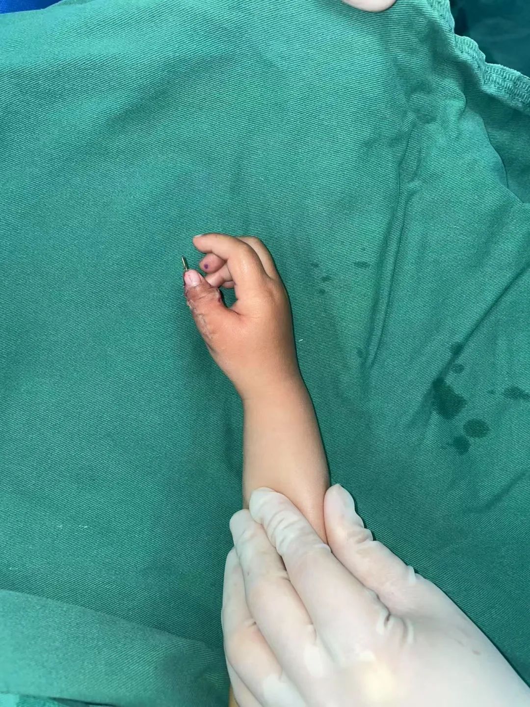 ͼƬ