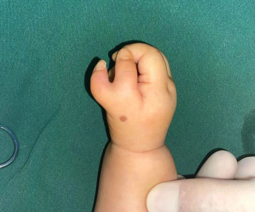 ͼƬ