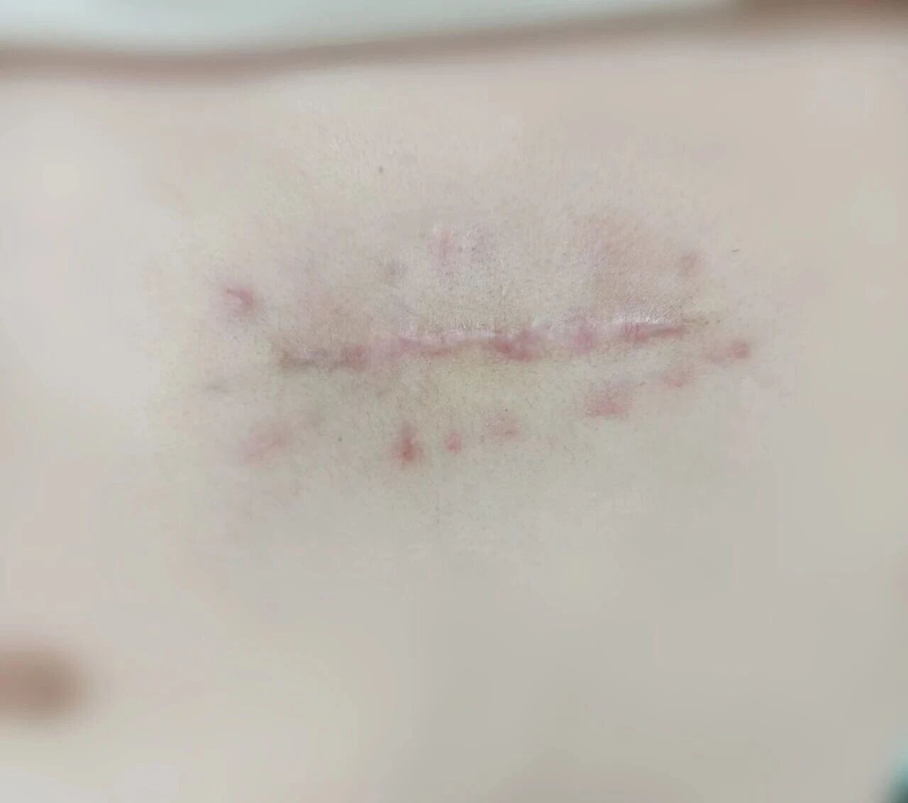 ͼƬ